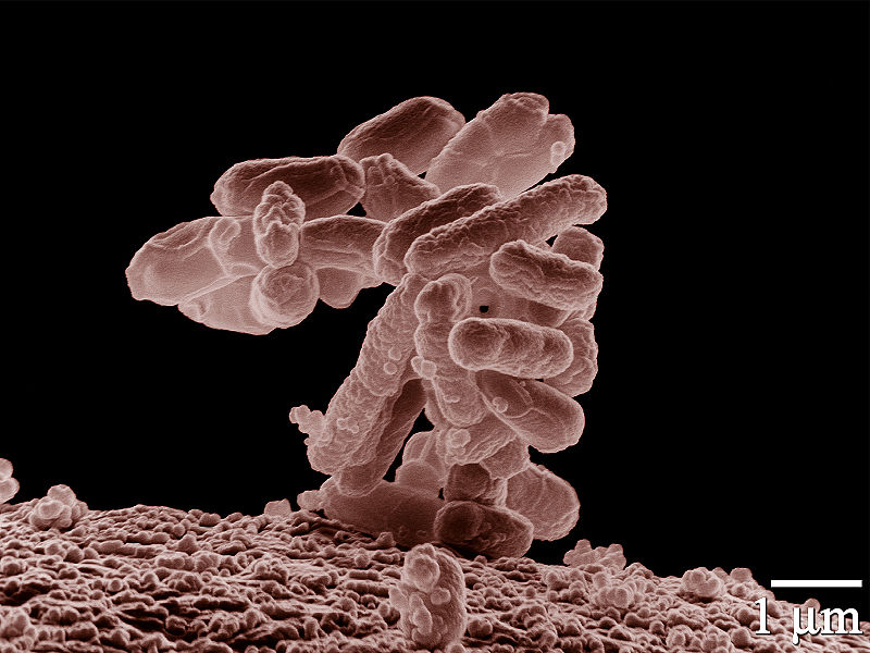 Deadly E. coli outbreak alarms Germany