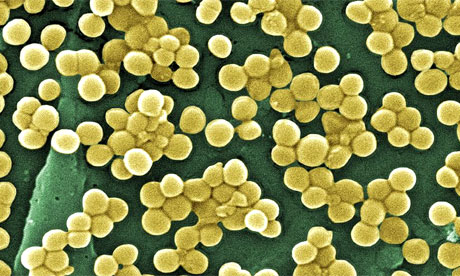 New type of MRSA in hospitalized patients discovered