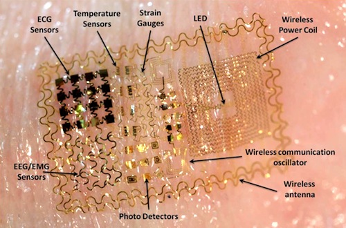 Annotated image of an epidermal device showing its various facets. Image courtesy John A. Rogers.